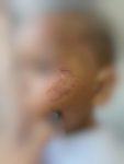 familia-denuncia-que-bebe-sofreu-quase-10-mordidas-em-creche-da-zona-norte-do-rio
