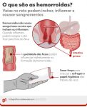 hemorroidas:-levar-celular-para-o-banheiro-favorece-o-surgimento-do-problema,-veja-como-evitar