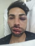 homem-e-brutalmente-espancado-em-sao-jose-dos-campos;-policia-investiga-o-caso