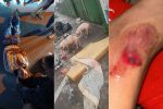 motociclista-fica-ferida-apos-colidir-com-porco-solto-em-rua-do-litoral-de-sp